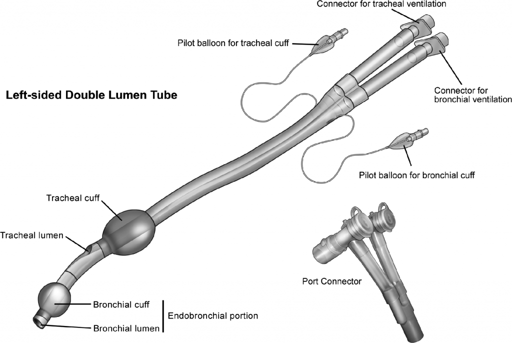 Replacing Double Lumen Tube with Single Lumen Tube - AP Technologies