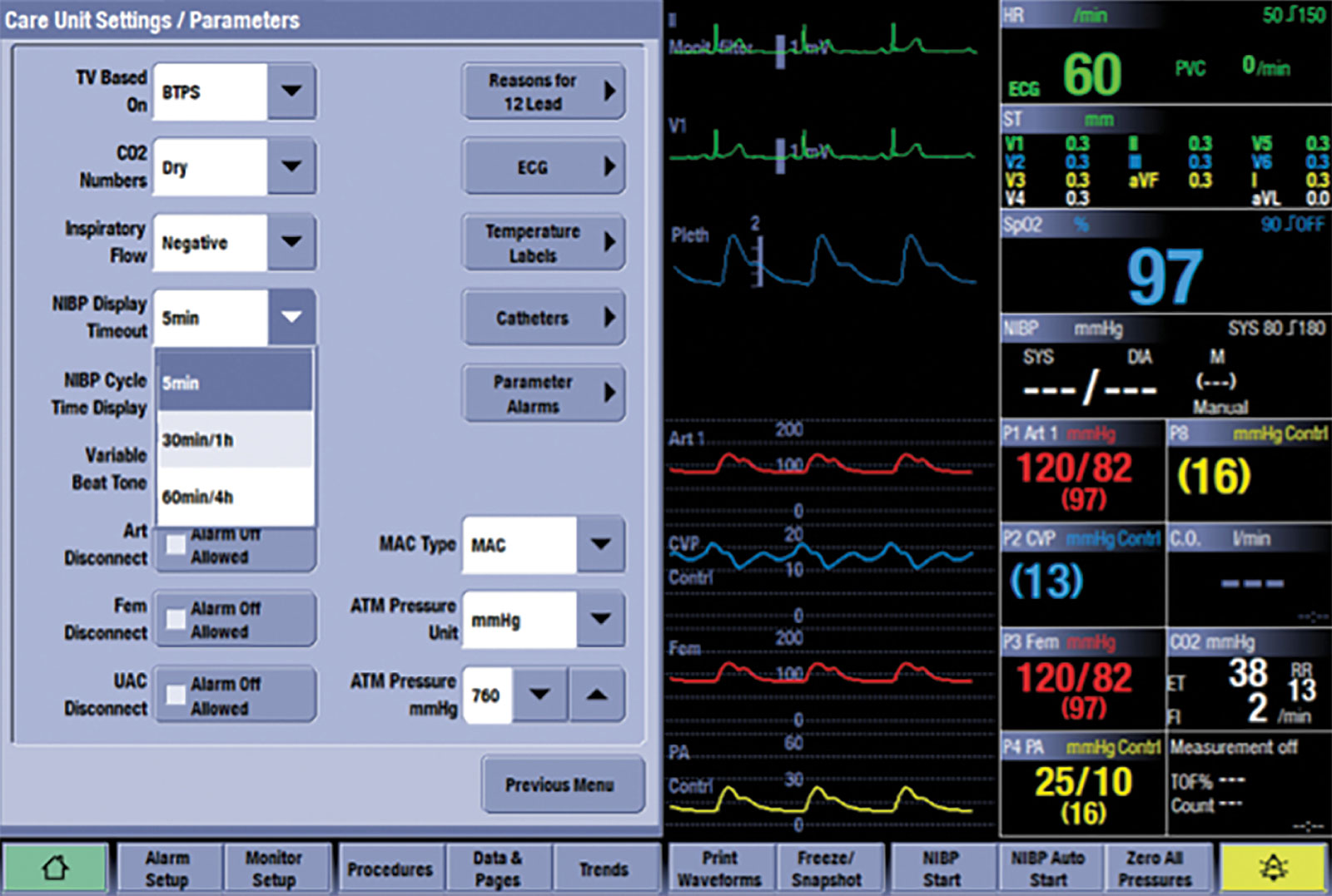 Monitoring Gaps Anesthesia Patient Safety Foundation