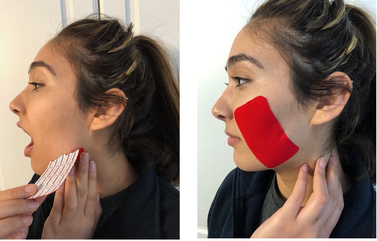 Sleep Bruxism? K Tape may help Advanced Physical Therapy Education