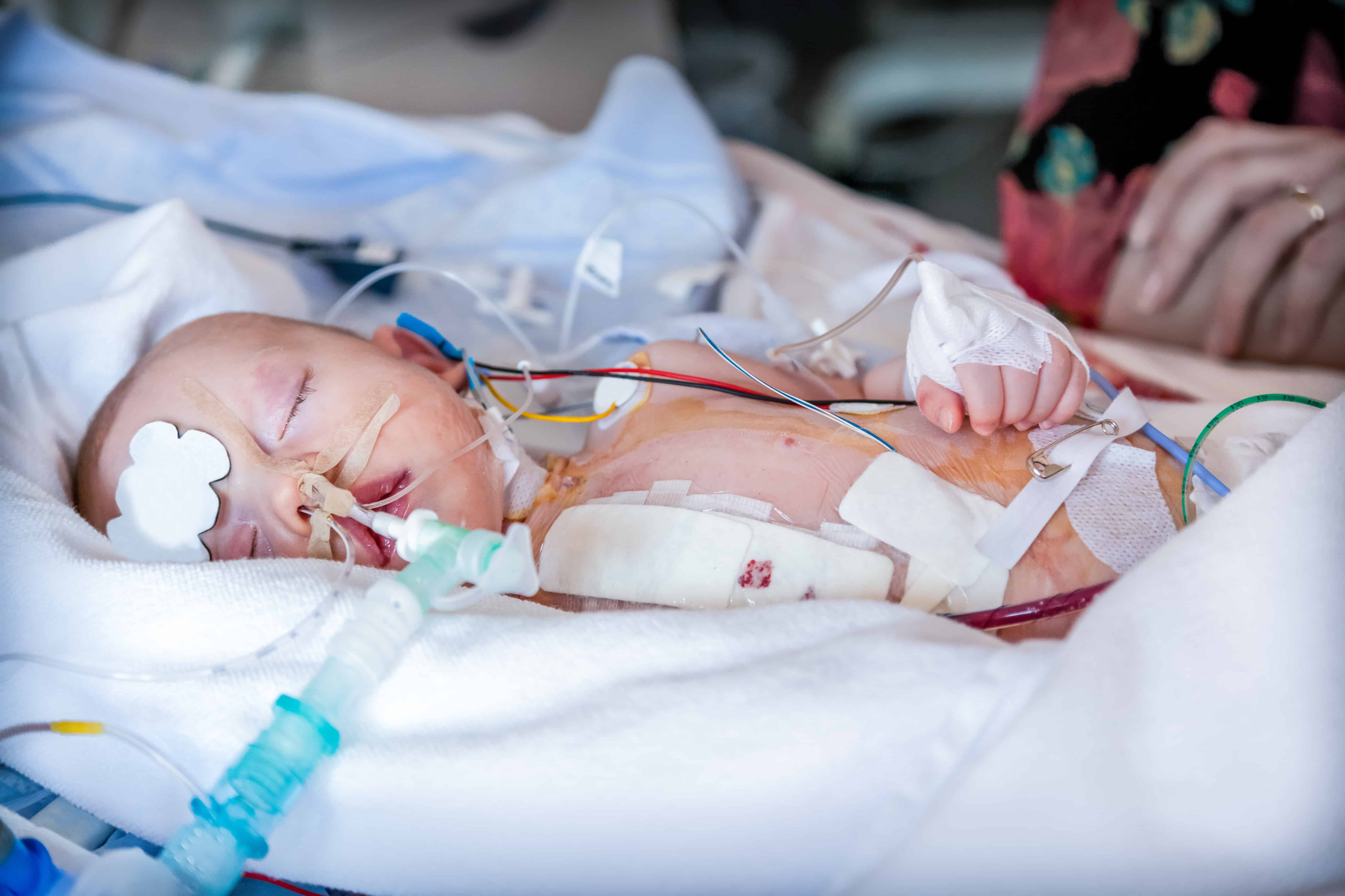 Child in intensive care unit after heart surgery. Shallow depth of