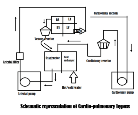 Cite sources in apa, mla, chicago, turabian, and harvard for free. Cardiopulmonary Bypass Basic Principles And Updates In Anaesthetic Management Arc Journal Of Anesthesiology