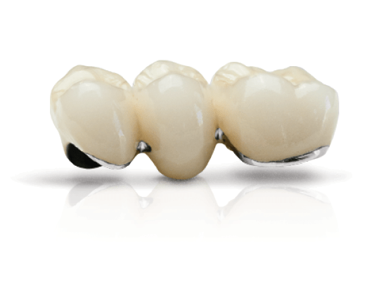 PFM Archives - Arklign