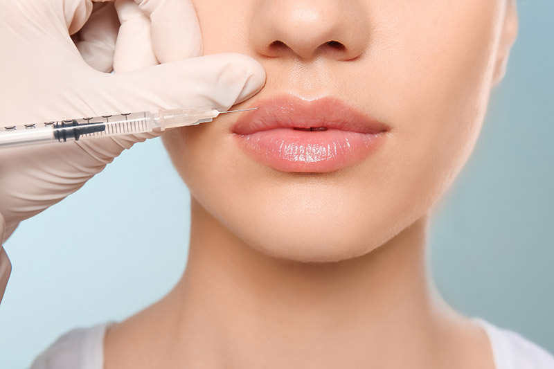 All About Lip Fillers at Artemedica in Santa Rosa and Healdsburg