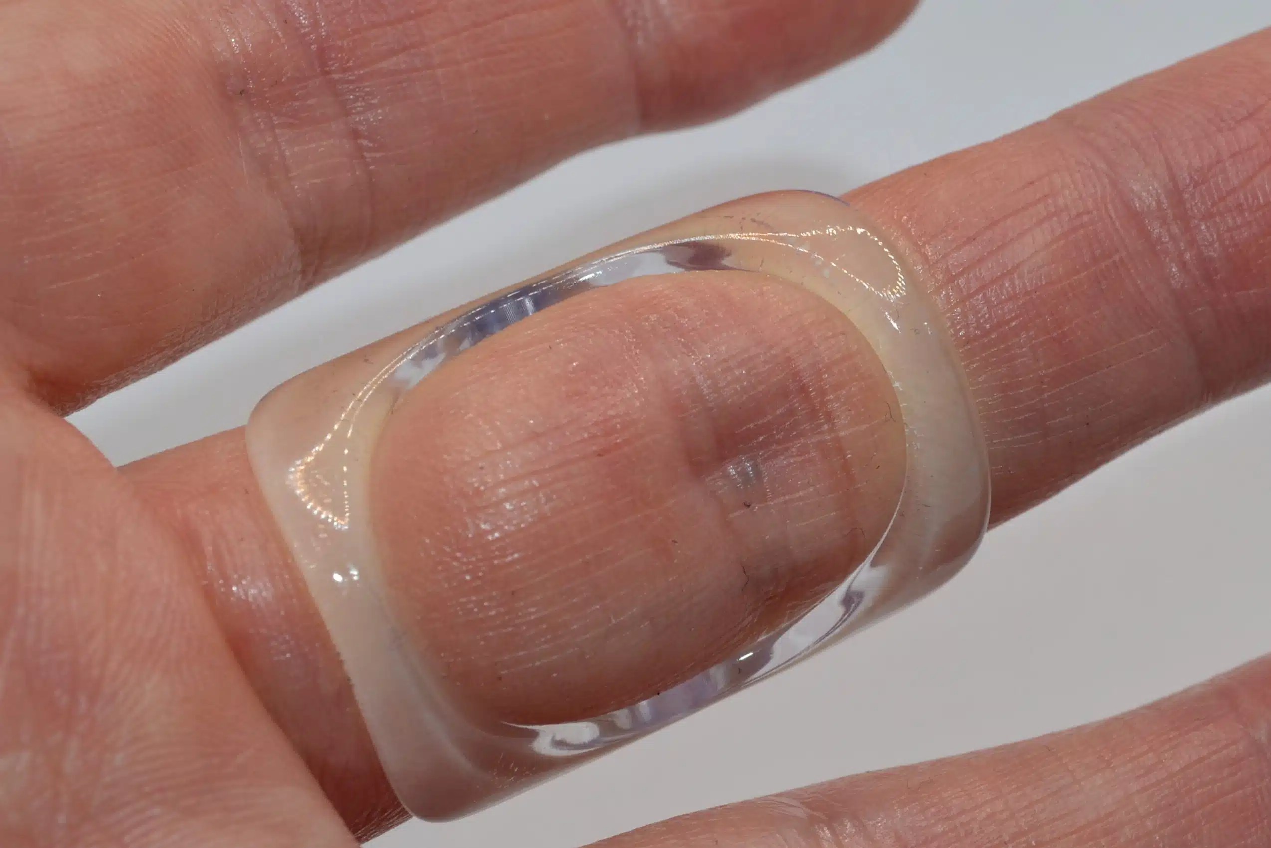 Finger Boutonniere Immobilise Joint Finger Injury ArthroEze Splints