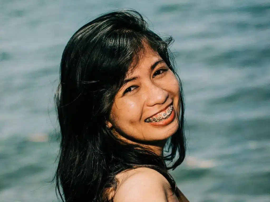 Straighten Out Your Smile With Braces Houston, TX