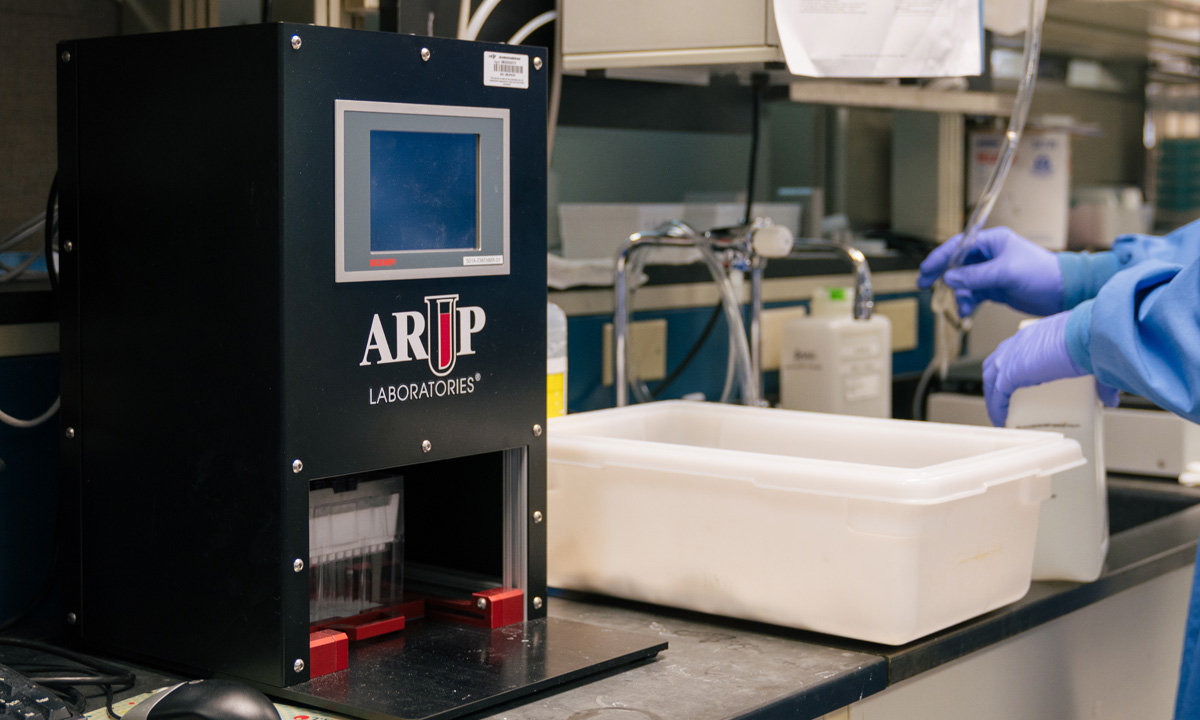 Robot Automates Major Lab’s Test in Unexpected Way ARUP Laboratories