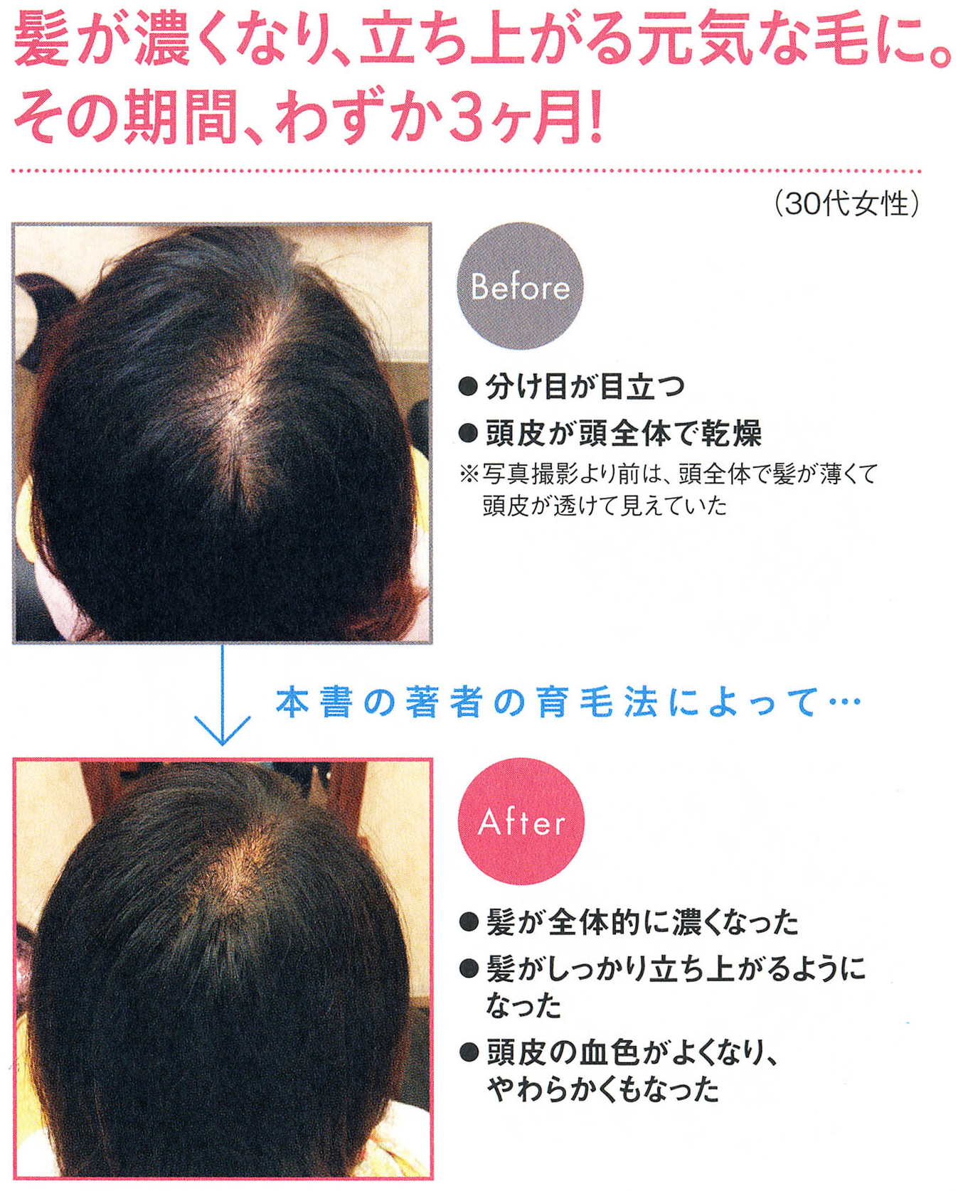 世界一簡単な髪が増える方法 株式会社アスコム