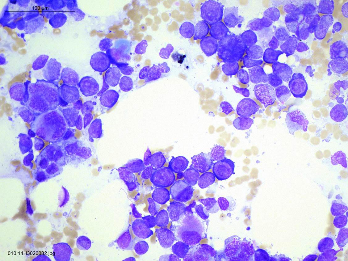 Herbal Drug Proves Effective Against AML Asian Scientist Magazine