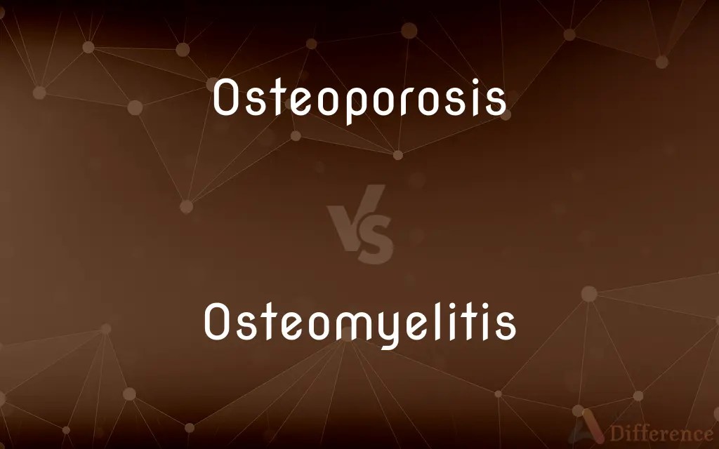 Osteoporosis vs. Osteomyelitis — What’s the Difference?