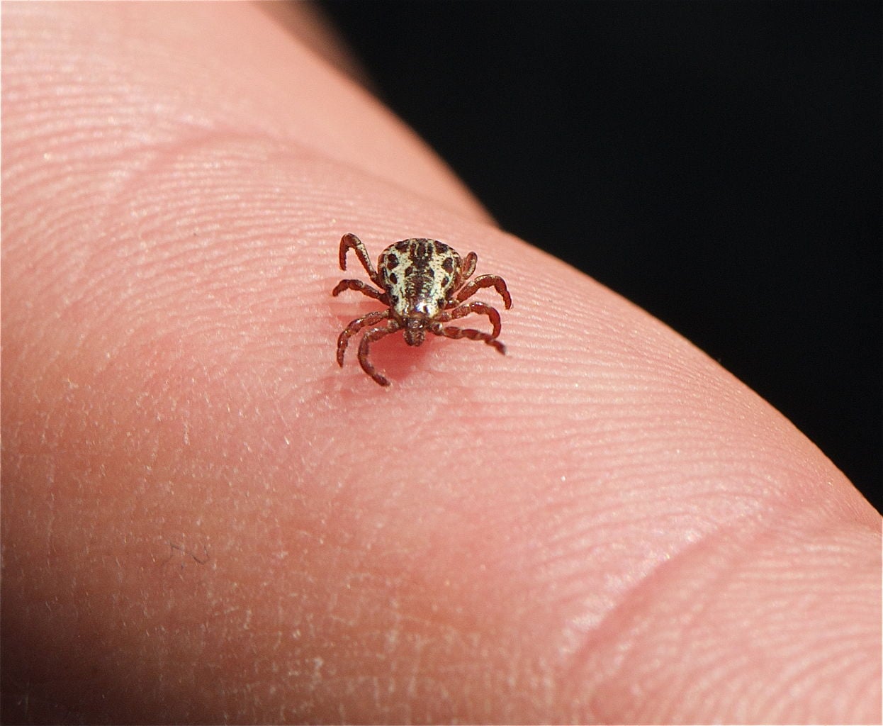 TickBorne Diseases on the AskDrManny