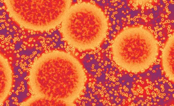 Norovirus (winter vomiting bug) life cycle, pathogenicity and