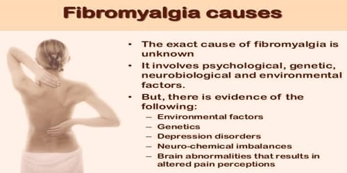 Fibromyalgia (Causes, Risk factors, and Complications) Assignment Point
