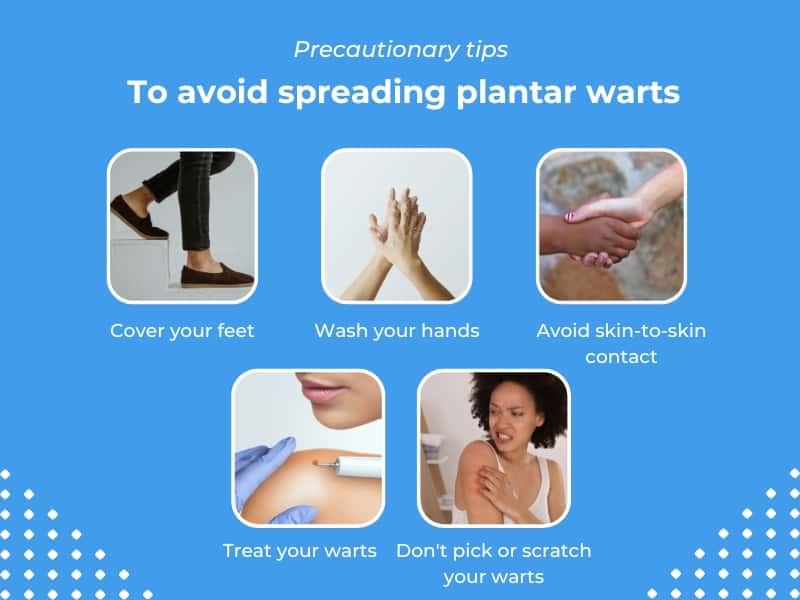 Are Plantar Warts Contagious Associated Dermatologists