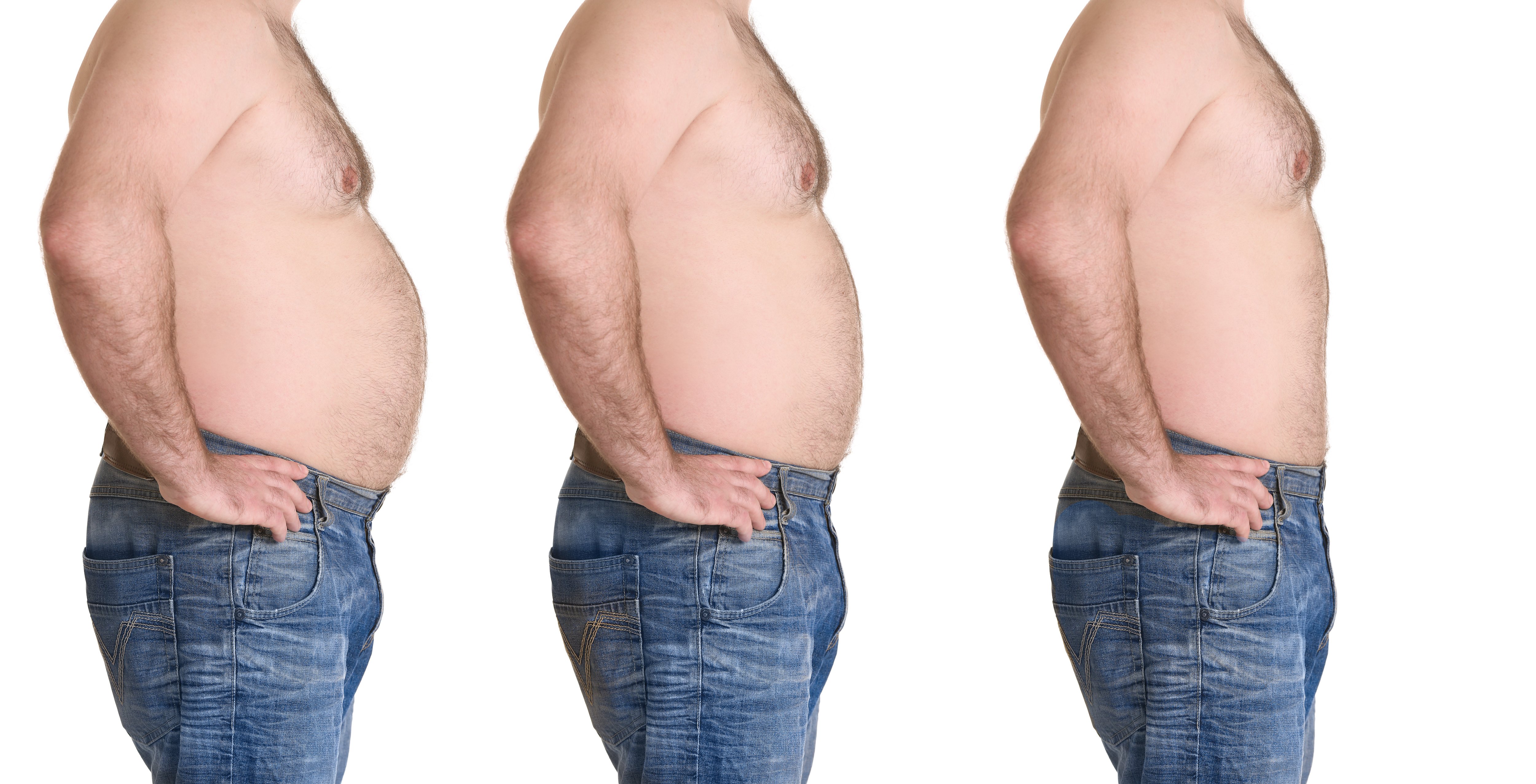 What To Expect When Taking Orlistat