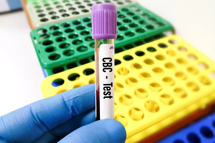 Full Blood Count Test Singapore SameDay Testing (2024)