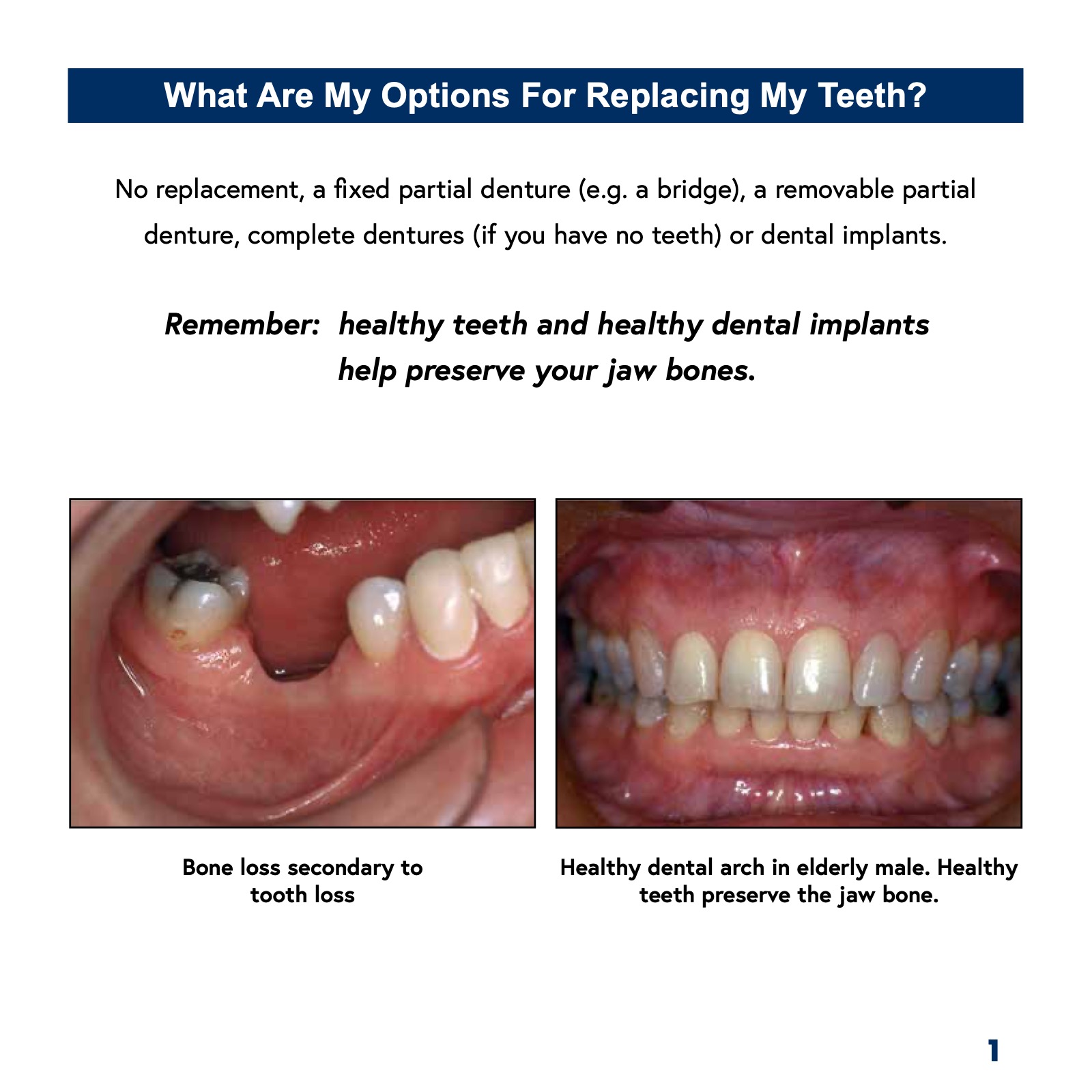 Patient's Guide to Dental Implants ATHENS DENTAL IMPLANT CENTER