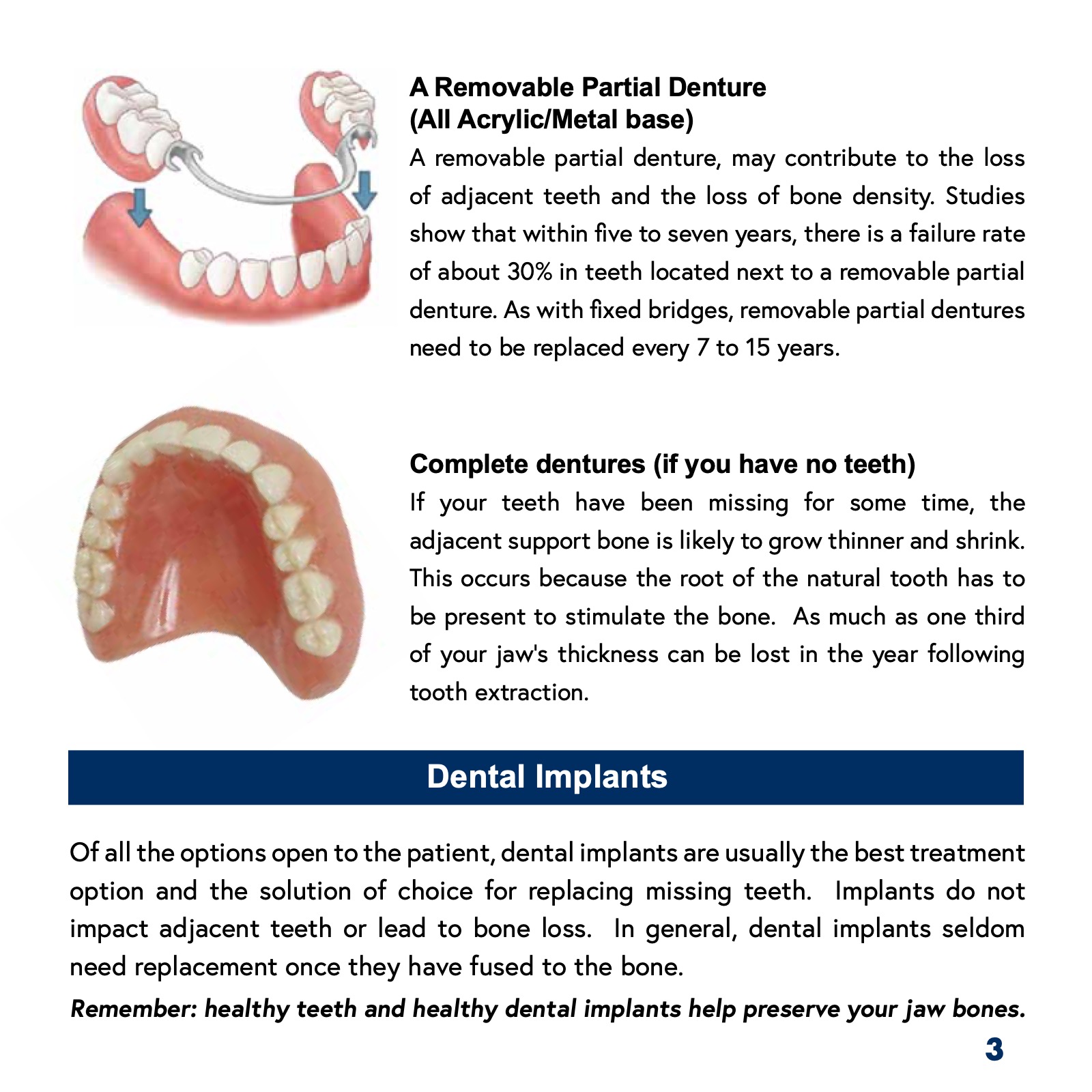 Patient's Guide to Dental Implants ATHENS DENTAL IMPLANT CENTER