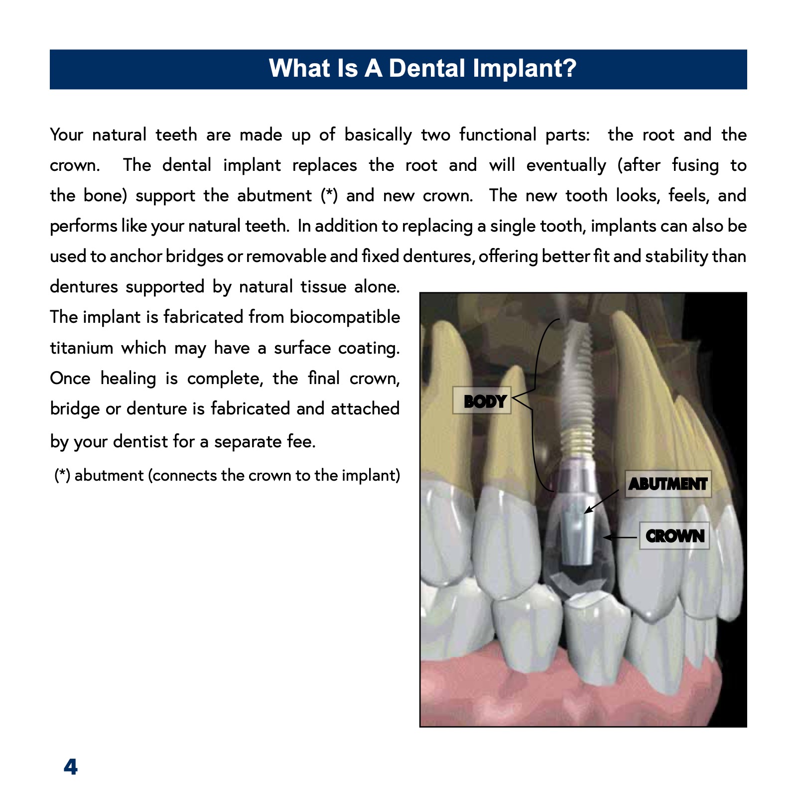 Patient's Guide to Dental Implants ATHENS DENTAL IMPLANT CENTER
