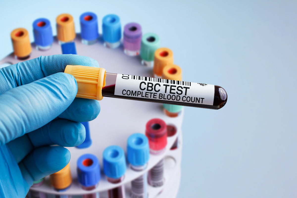Complete Blood Count For Athletes Explained (CBC) Athlete Blood Test