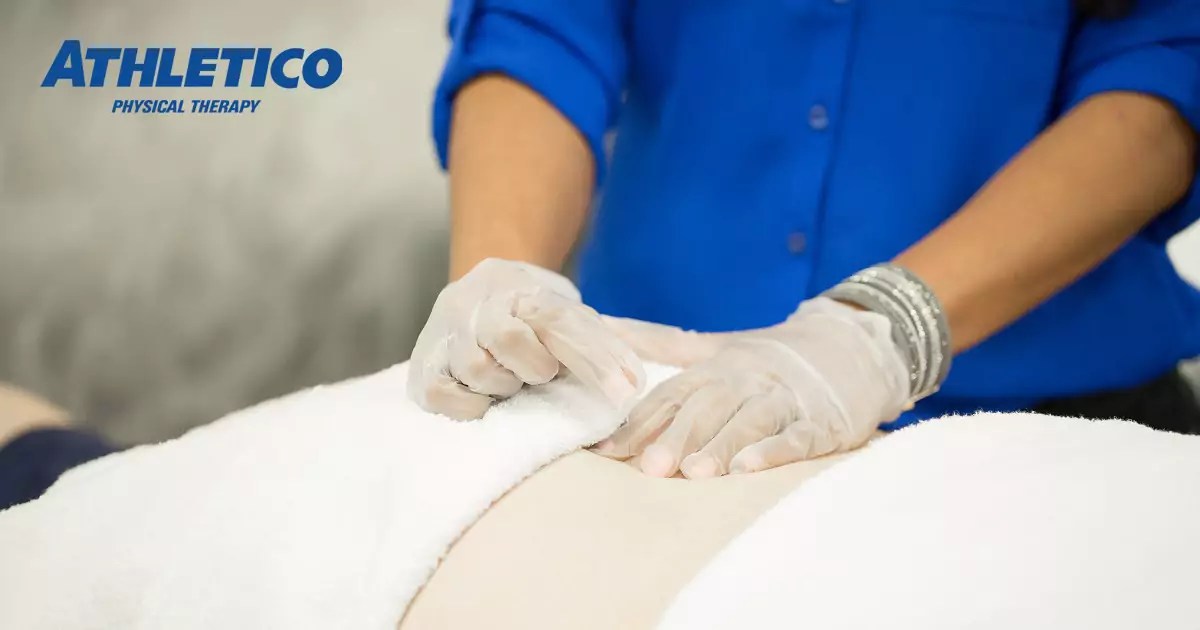 Can Dry Needling Help Sciatica Pain? Athletico