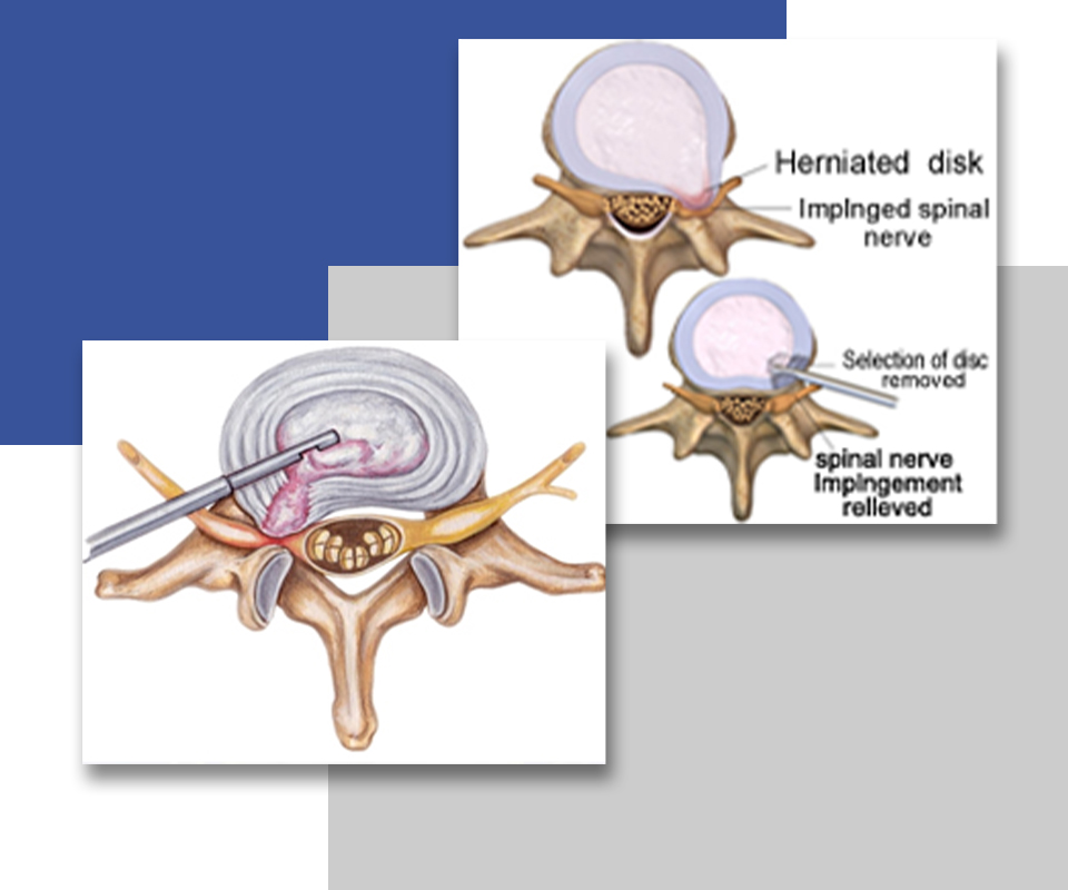 Spinal Atlas Pain Management Clinic