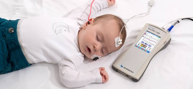 Examen ASSR L’Auditory Steady State Response