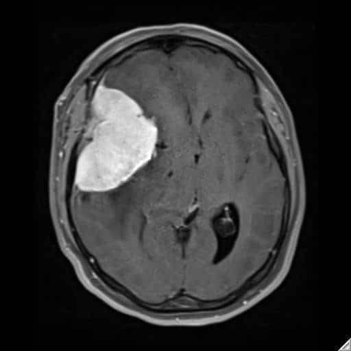 What Neuroradiologists Do Austin Radiological Association