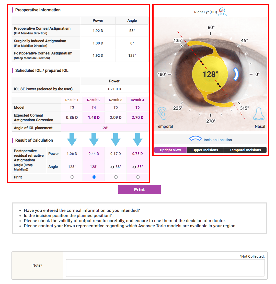 User Guide Toric Calculator Kowa Company.Ltd.
