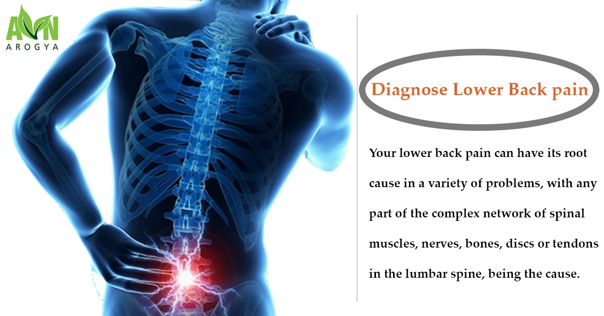 An Overview Of Low Back Pain Causes, Risk Factors And, 51 OFF