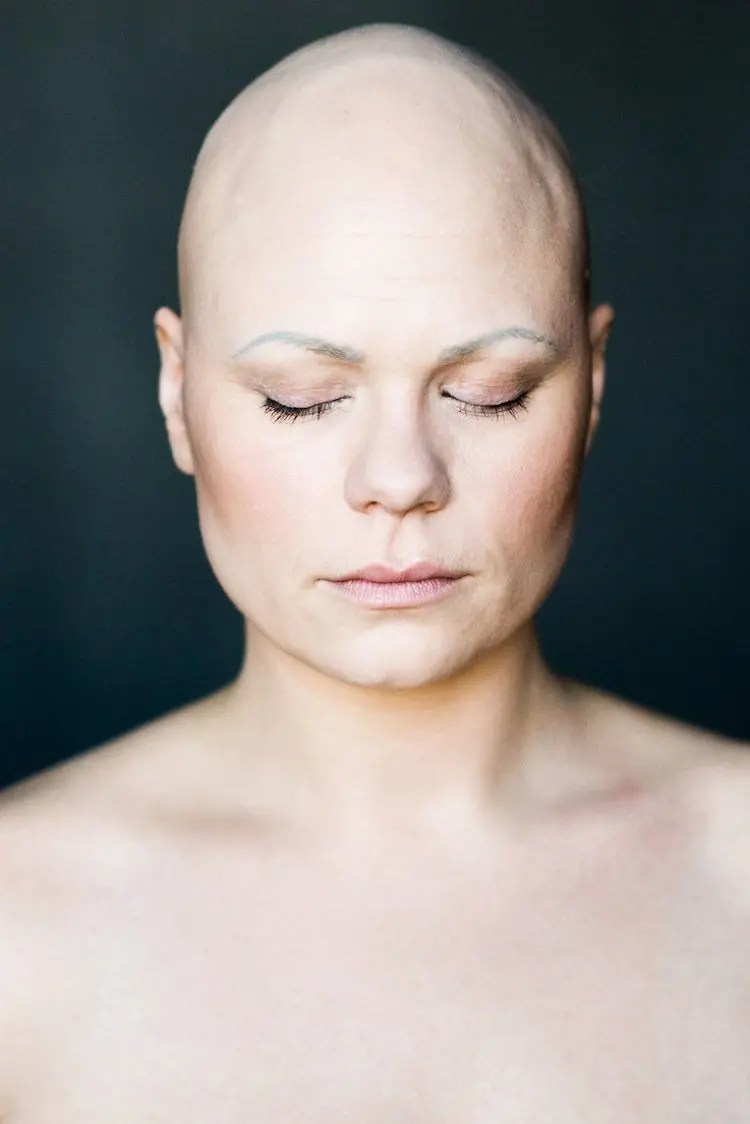 Photographer Sigga Ella Captures The Beauty Of Bald Women Photographer Sigga Ella Captures The Beauty Of Bald Women