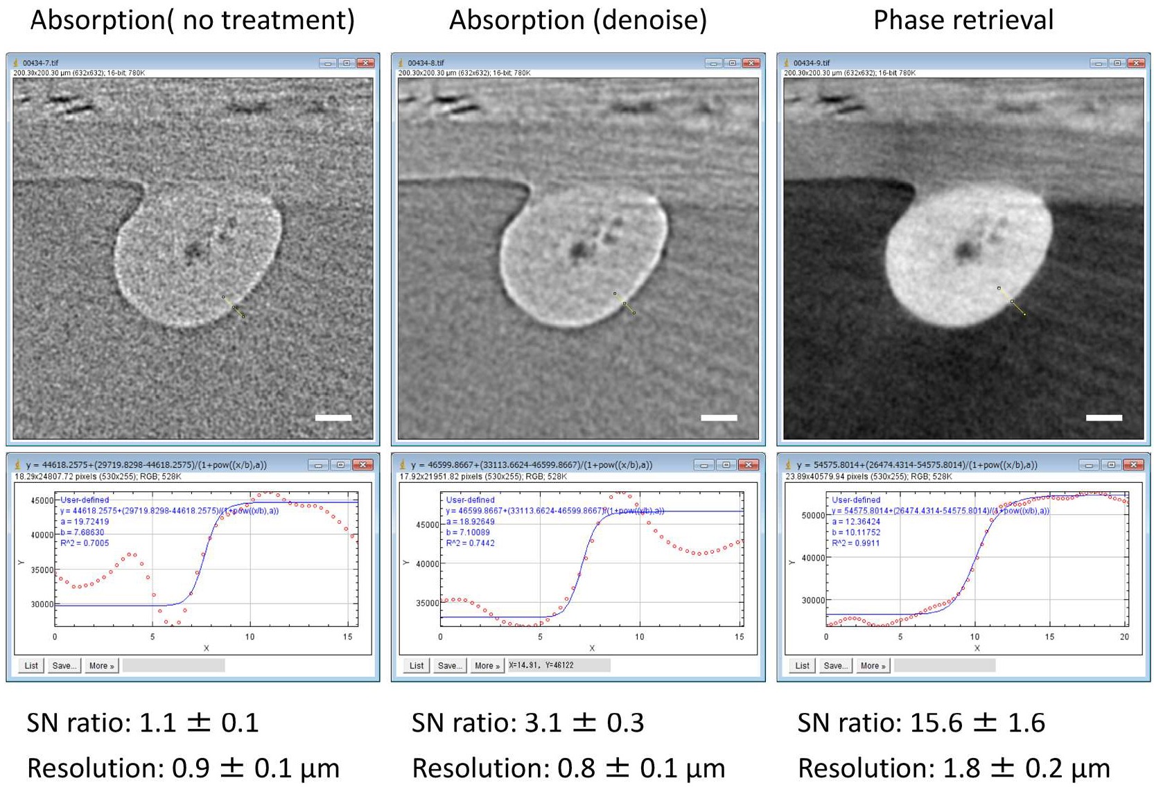 Computed Tomography Improved Xray Imaging Using Phase Retrieval