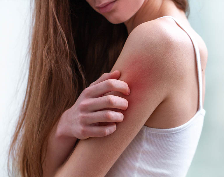 RASHES AND ALLERGIES Ayana Clinic