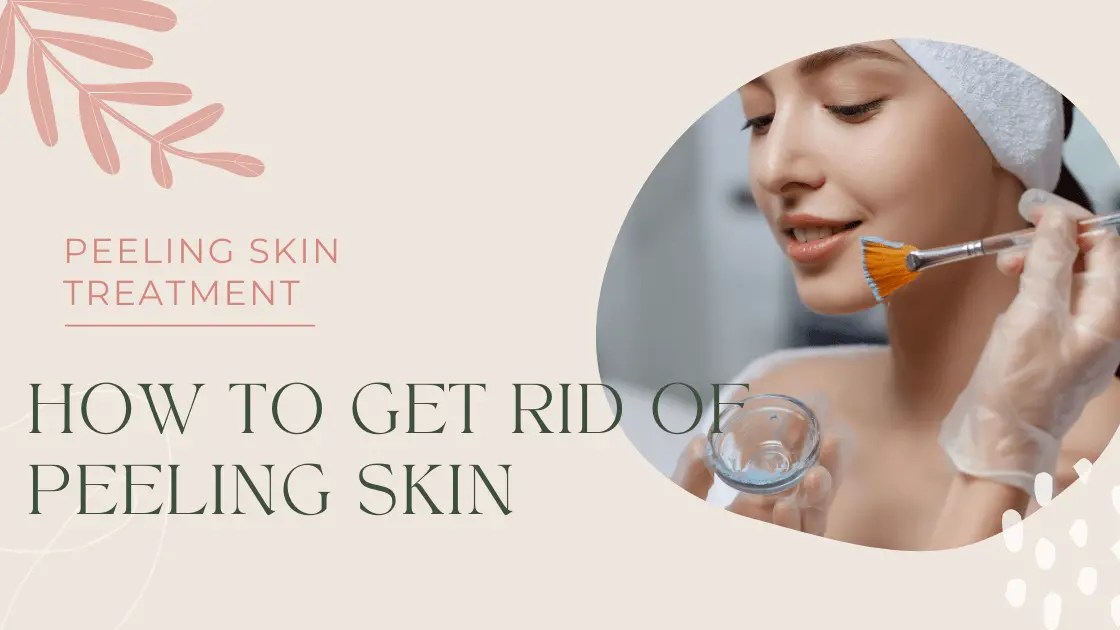 Peeling Skin Treatment Learn How To Get Rid Of Peeling Skin With Easy