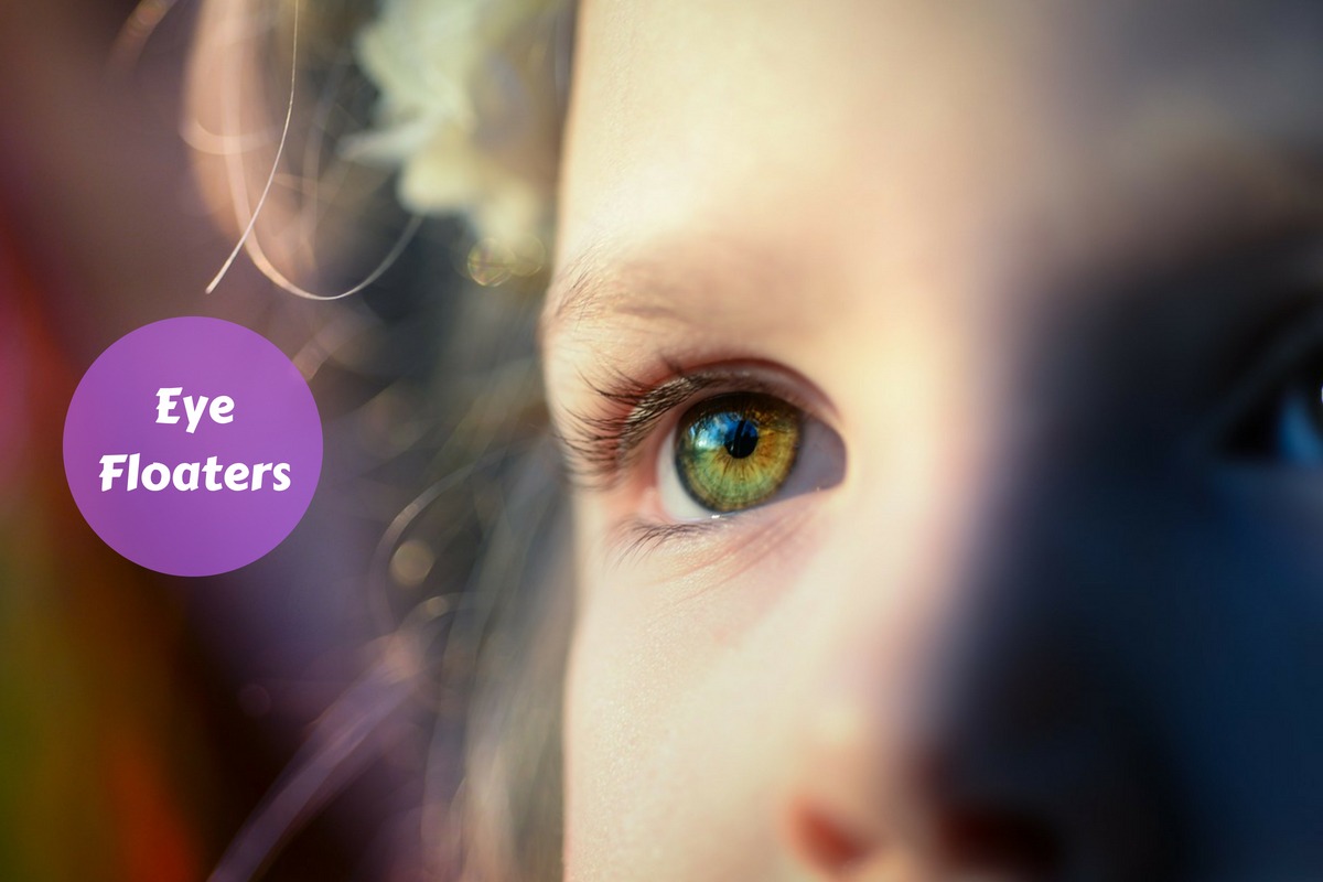 Eye Floaters Causes, Symptoms And Treatment