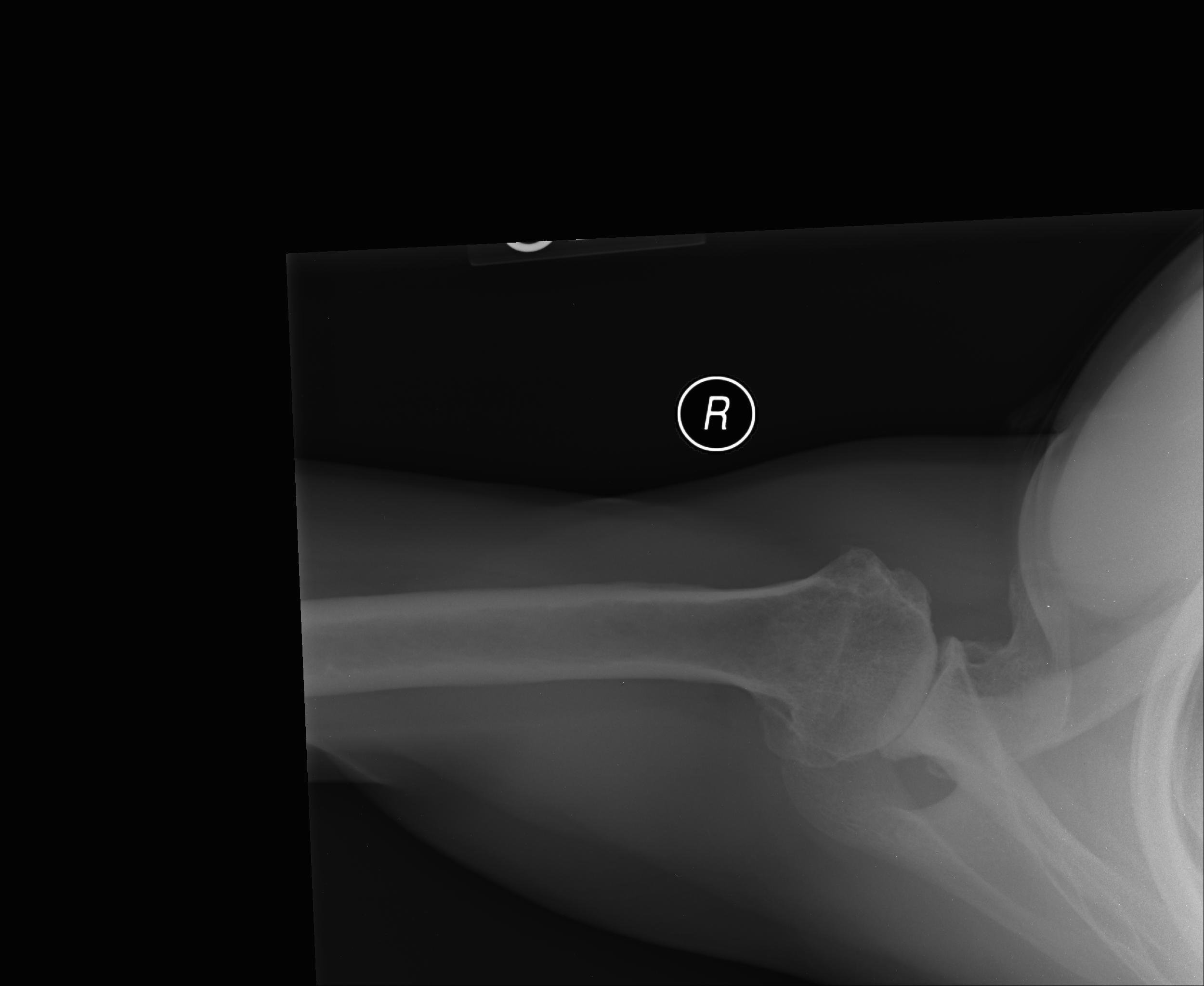 Arthritis xray axillary view Arizona Institute for Sports, Knees