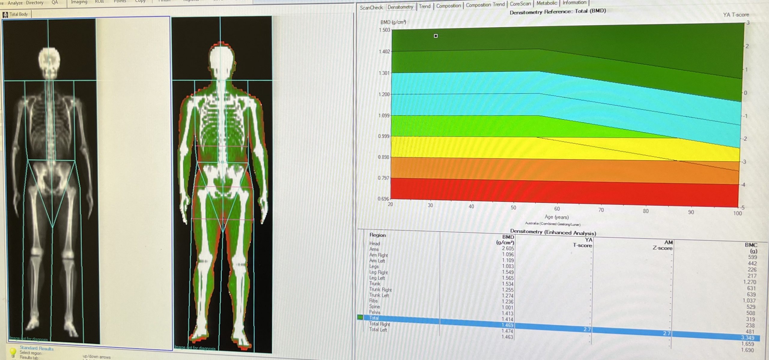How Much Dexa Body Scan Costs And Is It Worth It? Azure Medical