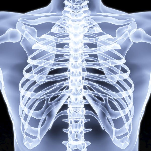 What is slipping rib syndrome? Charschan Chiropractic in North