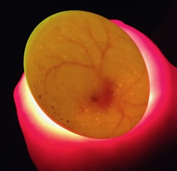 The First Week of Incubation Candling Eggs Day 7