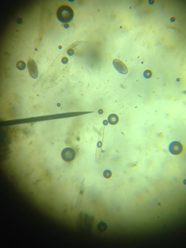 Doing Fecal Testing at Home BackYardHerds Goats, Horses, Sheep