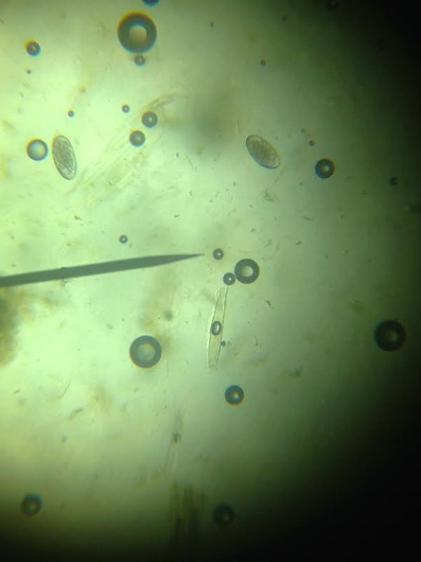 Doing Fecal Testing at Home BackYardHerds Goats, Horses, Sheep