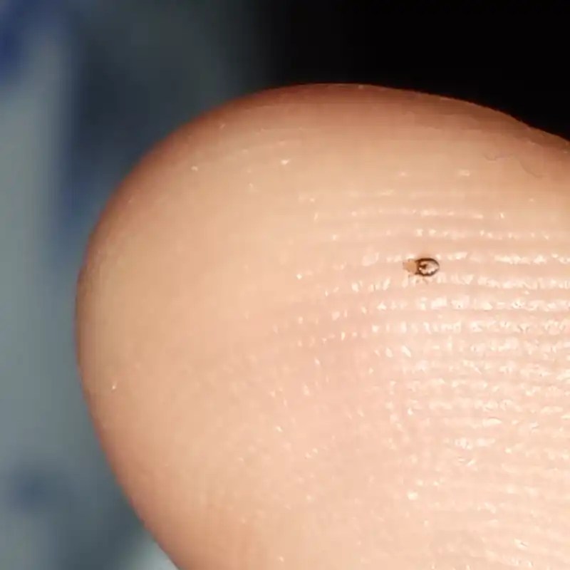 What Do Bed Bugs Look Like On Skin Online