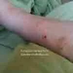 Schau dir am besten die verkehrslage in der nähe des hotels an, wenn du zeit sparen möchtest. Hotel Bedbugs: Check Registry of Hotels for Bed Bugs