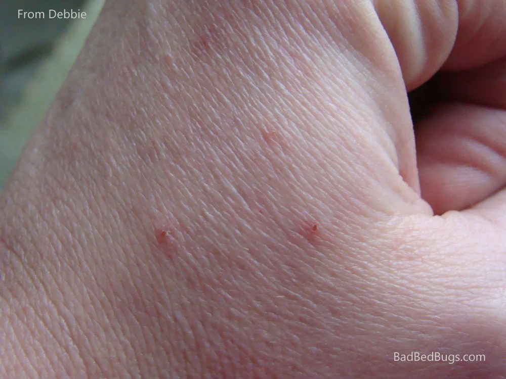 Hotel Bedbugs Check Registry of Hotels for Bed Bugs