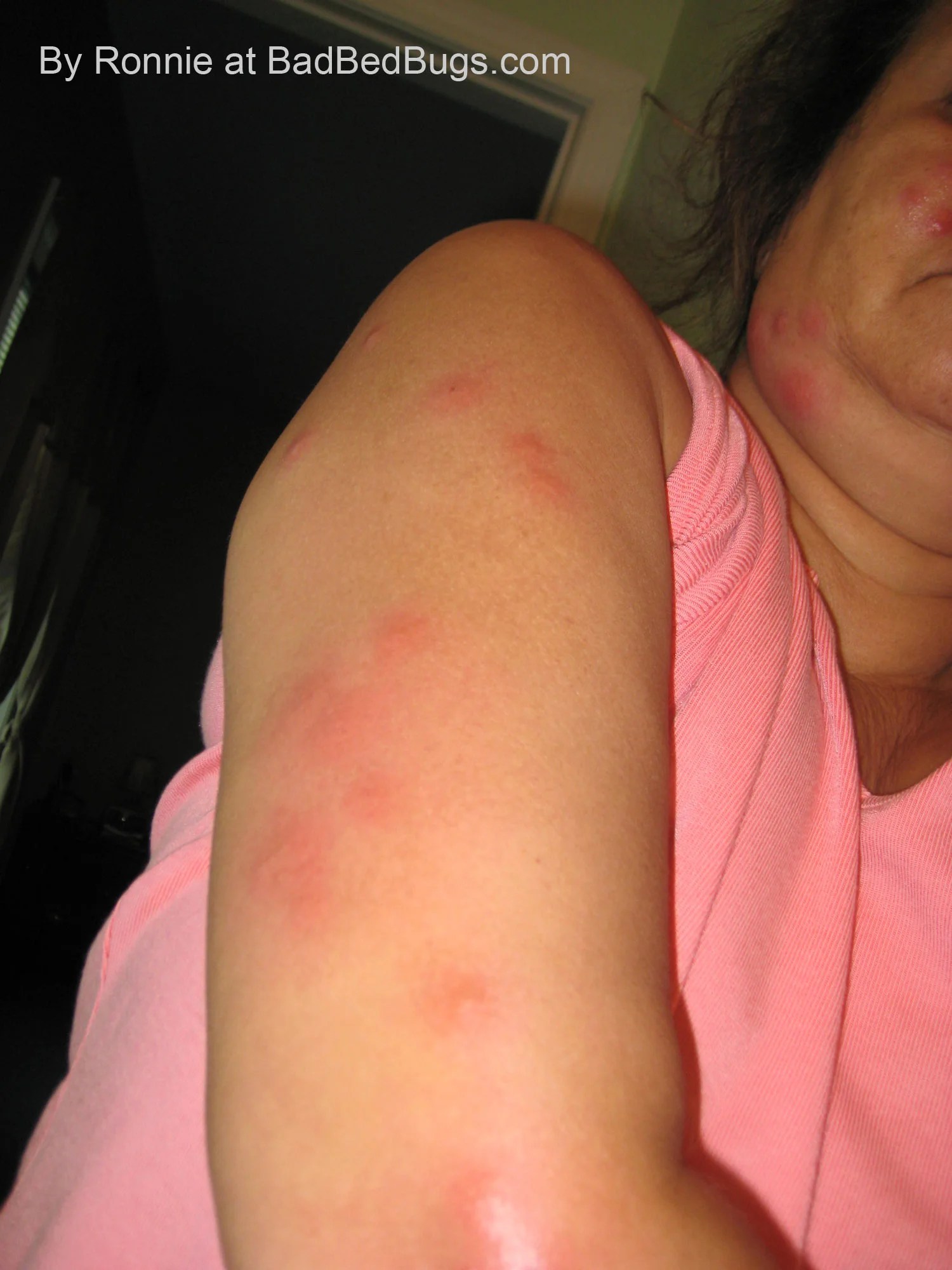 Bed Bug Complaint Registry Pg2