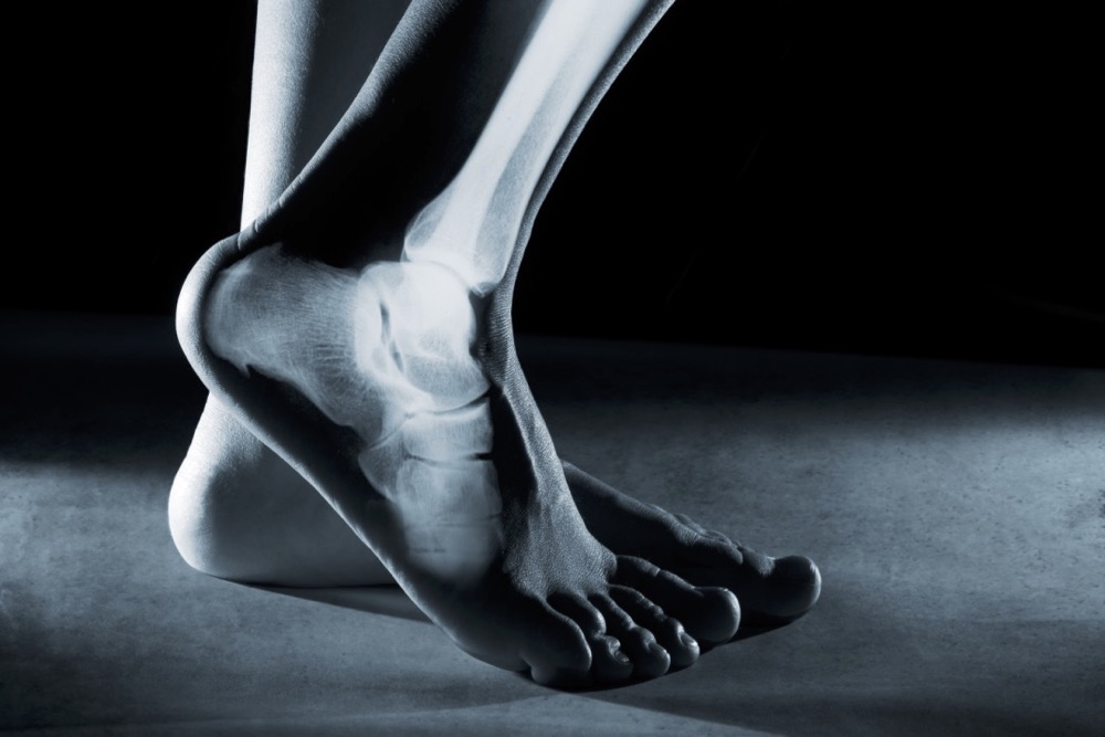 Foot & Ankle Pain Balance Foot & Ankle