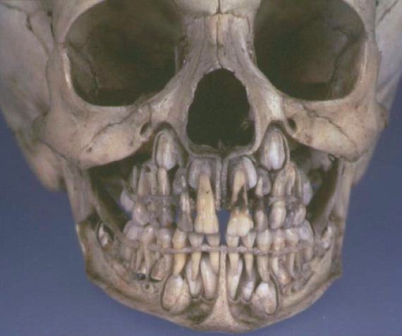 This Is What Your Skull Looks Like Before Losing Baby