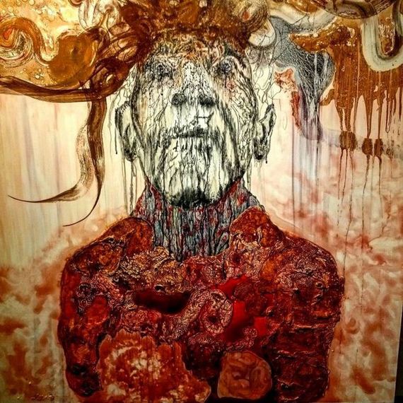 Paintings Dome By People With Schizophrenia Barnorama