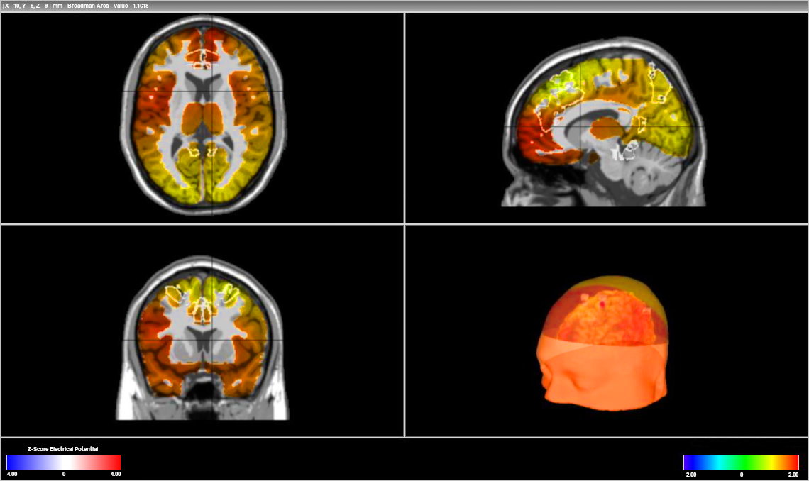 Bayside Neurotherapy Neurofeedback