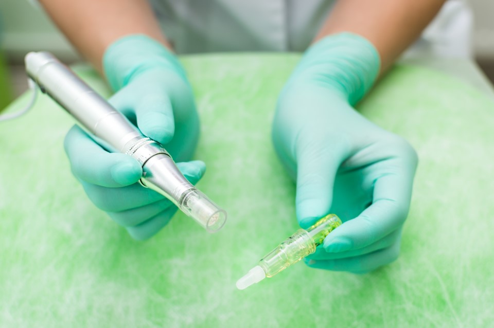Microneedling Might be Your Solution to Acne Scars
