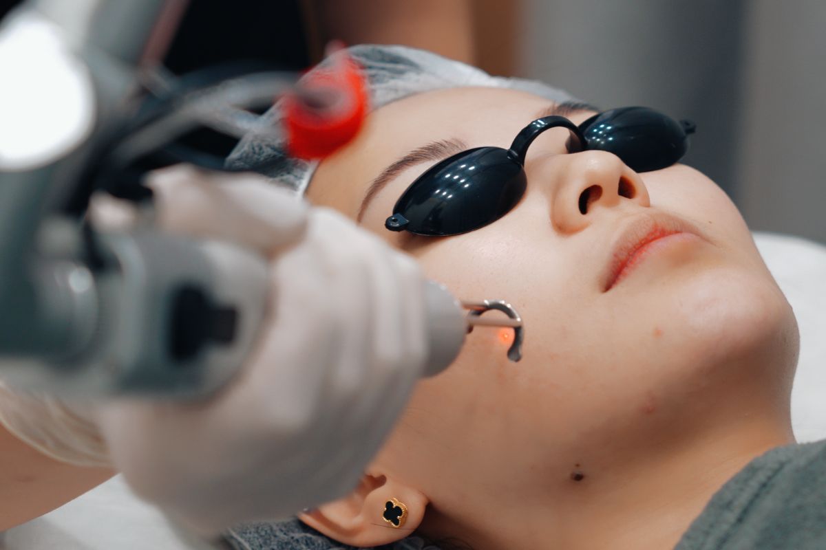 10 Key Considerations Before Getting Pico Laser Treatment